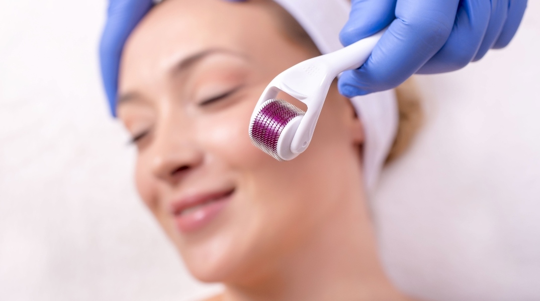 Derma Rolling: Λειτουργεί τελικά ή χαλάμε τζάμπα το δέρμα μας;