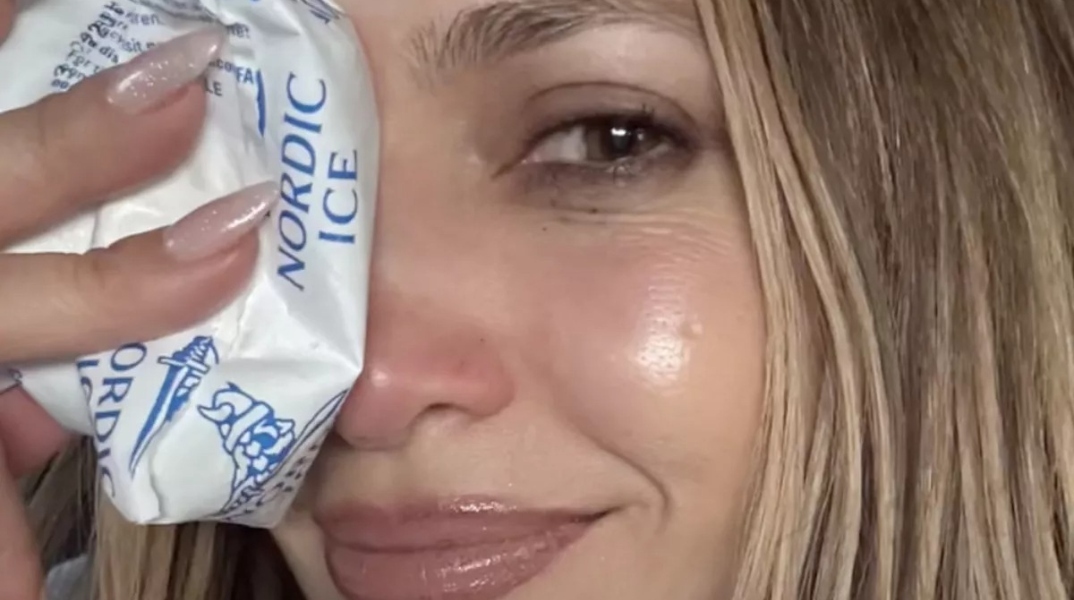 Το ατύχημα της Τζένιφερ Λόπεζ στις πρόβες 