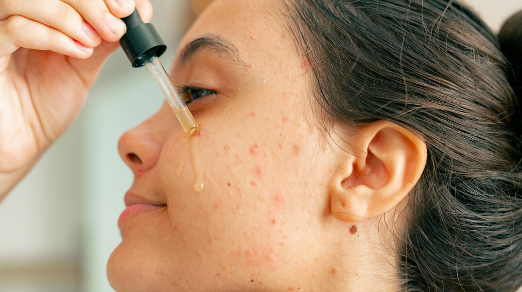 Resurfacing Retinol Serum της CeraVe