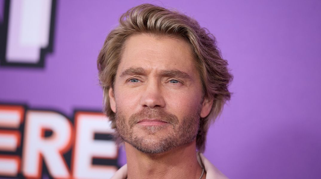 Viral έγινε φωτό του Τσαντ Μάικλ Μάρεϊ πριν σπάσει τη μύτη του στα 18 - Ο ηθοποιός αποκάλυψε πως έπεσε θύμα επίθεσης, γεγονός που άλλαξε τα χαρακτηριστικά του.