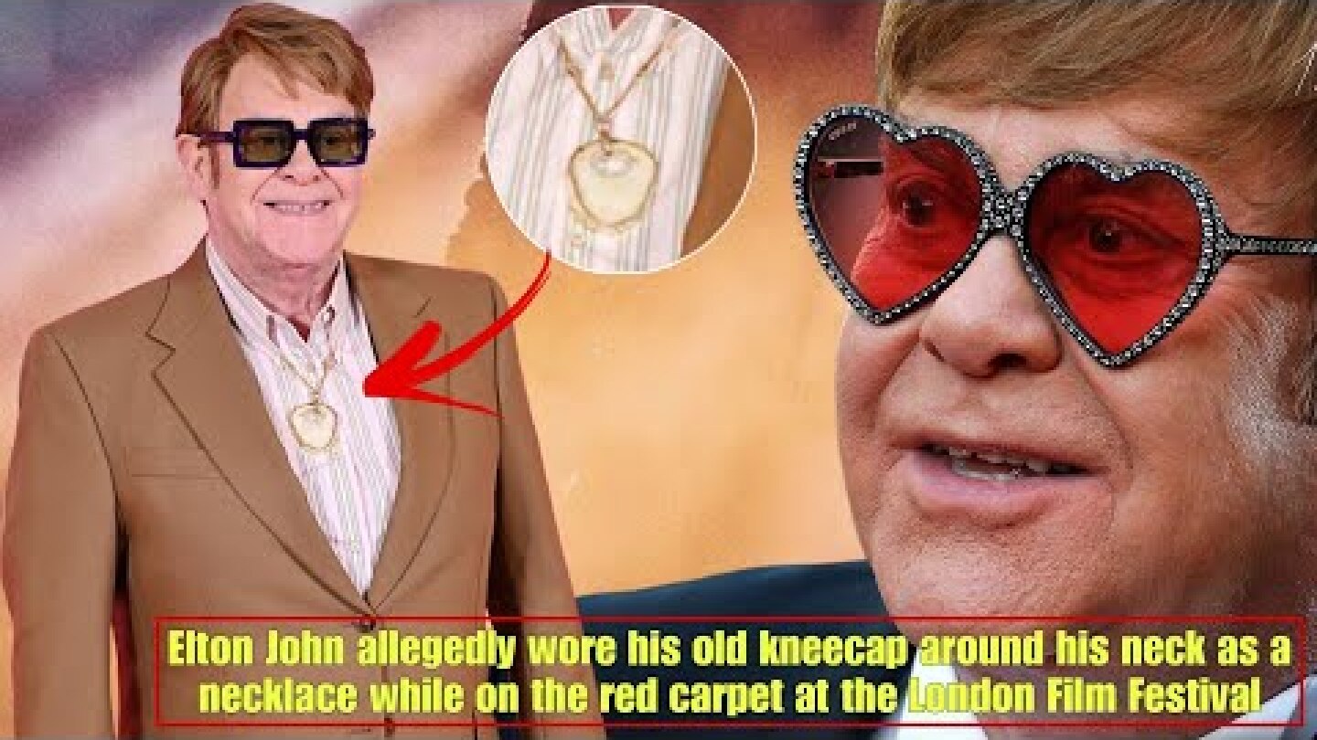 Elton John wears his old kneecap as a pendant around his neck following latest health scare