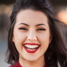 Τι τύπο χαμόγελου έχεις;