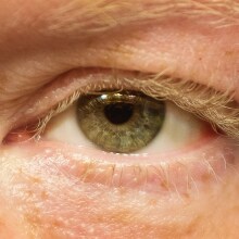 Γιατί κάποιοι άνδρες ξυρίζουν τις βλεφαρίδες τους