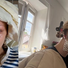 Η σιωπηλή ασθένεια της Μπέλα Χαντίντ: Το χρονικό της μάχης με τη νόσο του Lyme