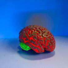 Ομοίωμα εγκεφάλου