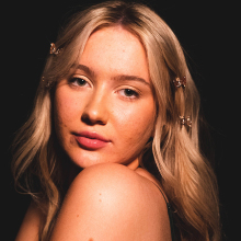 Κοπέλα με ακμή στο πρόσωπο