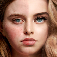 Selfie self esteem: Πιέσεις στα μέσα κοινωνικής δικτύωσης 