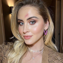 Η Valentina Ferragni με την ουλή στο πρόσωπο