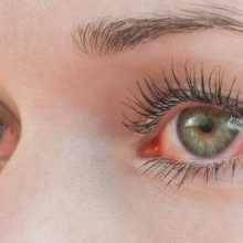 Oφθαλμολογικά προβλήματα