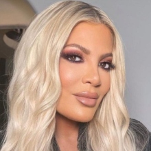 Η Τόρι Σπέλινγκ απέκτησε καινούρια δόντια 