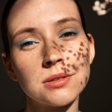 πρόσωπο με κηλίδες 