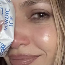 Το ατύχημα της Τζένιφερ Λόπεζ στις πρόβες 