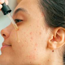 Resurfacing Retinol Serum της CeraVe