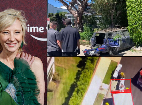 H Anne Heche υπέστη σοβαρά εγκαύματα μετά από τροχαίο στο Λος Άντζελες