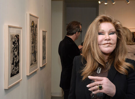 Tζόσλιν Γουιλντενστάιν: Πέθανε η «catwoman»,  η κοσμική γυναίκα γνωστή για τον εθισμό της στις αισθητικές επεμβάσεις