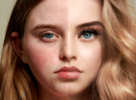 Selfie self esteem: Πιέσεις στα μέσα κοινωνικής δικτύωσης 