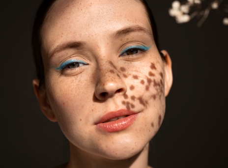 πρόσωπο με κηλίδες 