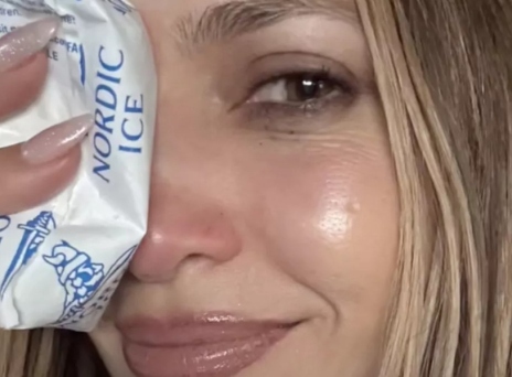 Το ατύχημα της Τζένιφερ Λόπεζ στις πρόβες 