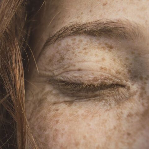 Ψεύτικες φακίδες: Το beauty trend που γίνεται μέχρι και τατουάζ