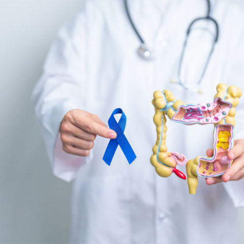 καρκίνος παχέος εντέρου