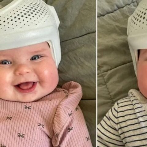 Φοράει κράνη στα δίδυμα μωρά της και εξηγεί το γιατί