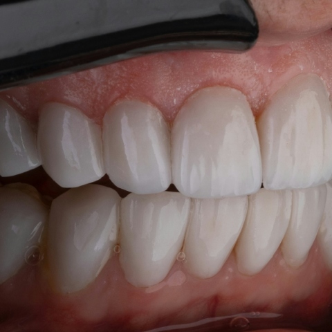 Ο αγώνας μιας γυναίκας να σώσει τα δόντια της, της κόστισε τη δουλειά και την υγεία της