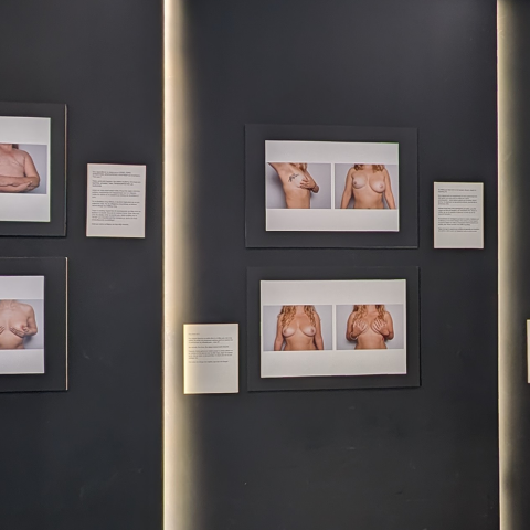 Σύλβια Κουβέλη: «Θέλω οι εκθέσεις του boobs να γίνουν αφορμή για να ανοίξει μια δύσκολη συζήτηση»