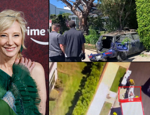 H Anne Heche υπέστη σοβαρά εγκαύματα μετά από τροχαίο στο Λος Άντζελες