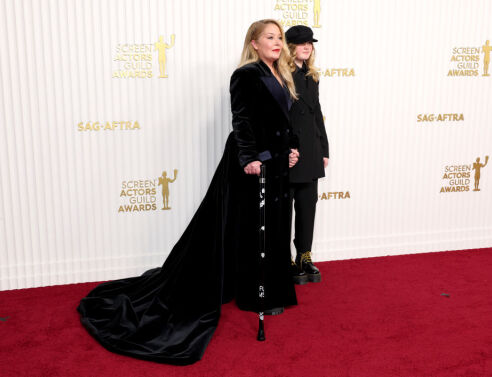 Κριστίνα Άπλγκεϊτ: Η σοκαριστική αλλαγή Άπλγκεϊτ από τη σκλήρυνση κατά πλάκας - Δείτε βίντεο