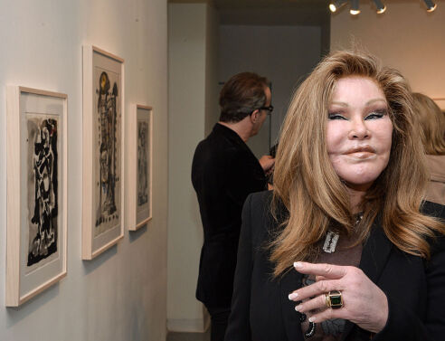 Tζόσλιν Γουιλντενστάιν: Πέθανε η «catwoman»,  η κοσμική γυναίκα γνωστή για τον εθισμό της στις αισθητικές επεμβάσεις