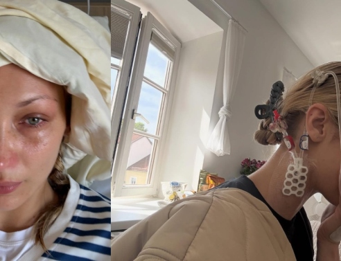 Η σιωπηλή ασθένεια της Μπέλα Χαντίντ: Το χρονικό της μάχης με τη νόσο του Lyme