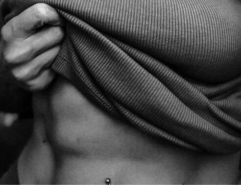 Πλαστική επέμβαση