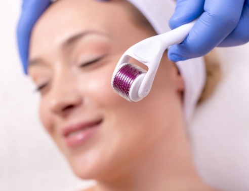Derma Rolling: Λειτουργεί τελικά ή χαλάμε τζάμπα το δέρμα μας;