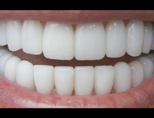How To Have Natural White Teeth in 3 minutes ( Works 100% )