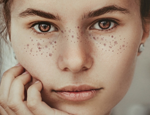 Δες 6 τρόπους που θα σε σταματήσουν από το να αγγίζεις συνεχώς το πρόσωπό σου