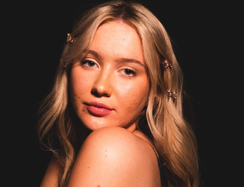 Κοπέλα με ακμή στο πρόσωπο