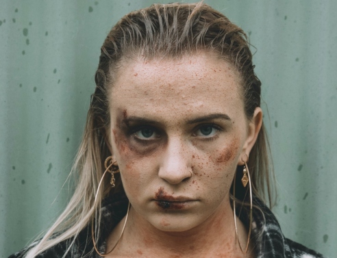 Βία κατά των γυναικών