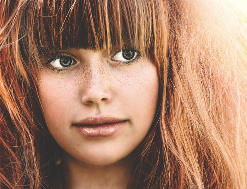  5 tips που πρέπει να γνωρίζει κάθε κορίτσι με φακίδες