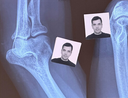 Φωτογραφίες ταυτότητας πάνω σε ακτινογραφία