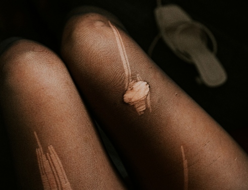 Το απόλυτο hack για να μη σκίζονται τα καλσόν 