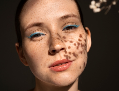 πρόσωπο με κηλίδες 