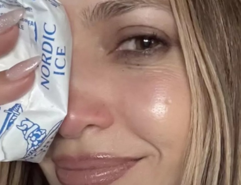 Το ατύχημα της Τζένιφερ Λόπεζ στις πρόβες 