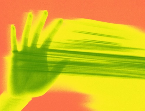 Πεθαίνω, με βλέπεις;