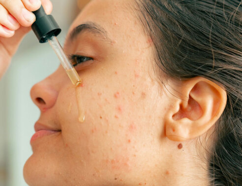 Resurfacing Retinol Serum της CeraVe