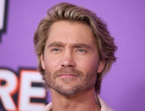 Viral έγινε φωτό του Τσαντ Μάικλ Μάρεϊ πριν σπάσει τη μύτη του στα 18 - Ο ηθοποιός αποκάλυψε πως έπεσε θύμα επίθεσης, γεγονός που άλλαξε τα χαρακτηριστικά του.