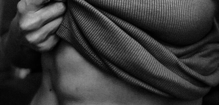 Πλαστική επέμβαση