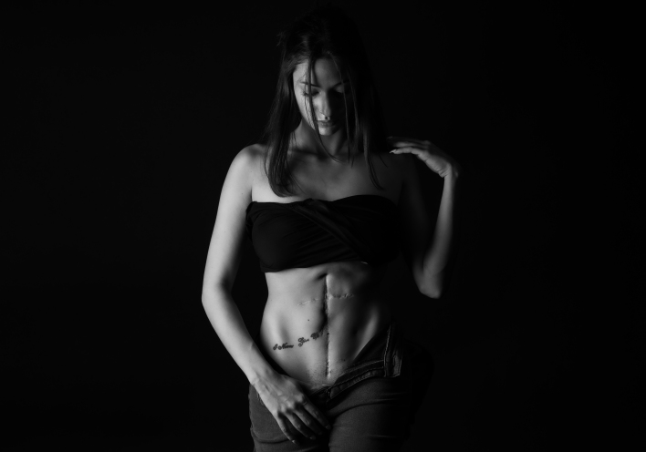 Oυλές στο σώμα