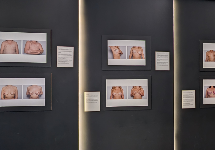 Σύλβια Κουβέλη: «Θέλω οι εκθέσεις του boobs να γίνουν αφορμή για να ανοίξει μια δύσκολη συζήτηση»