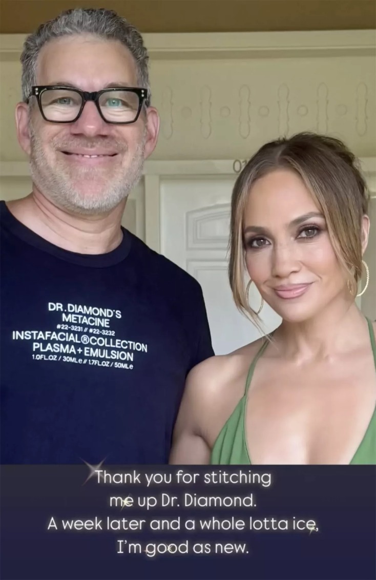 Το ατύχημα της Τζένιφερ Λόπεζ στις πρόβες 